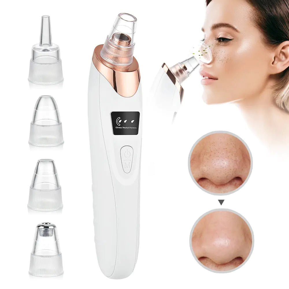 Blackhead remover