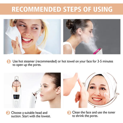 Blackhead remover